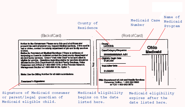 Idaho Medicaid Program Resource Limits